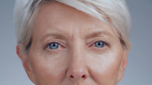 Blépharoplastie